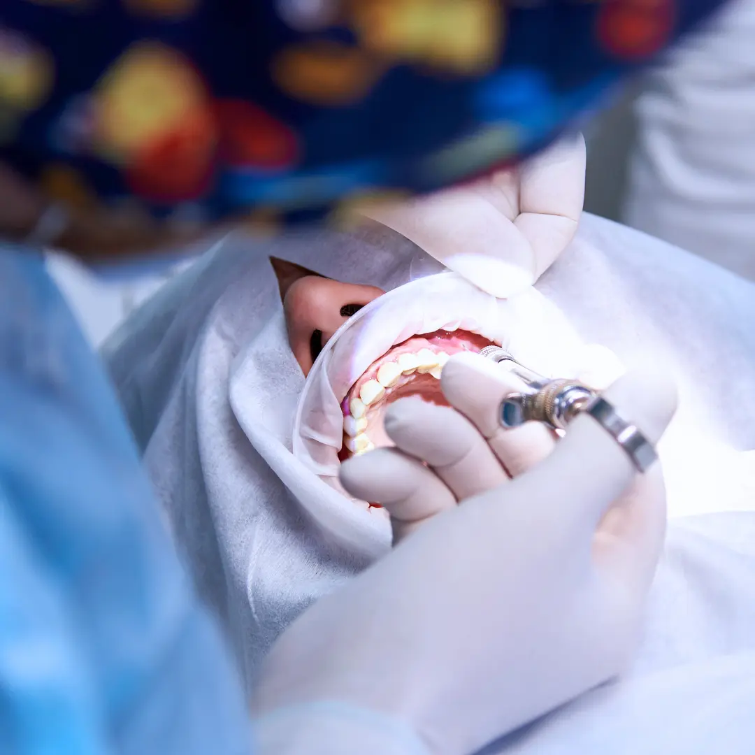 Chirurgie Dentara