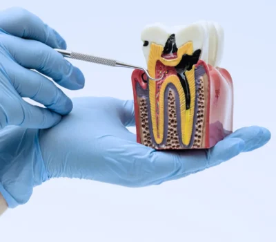 Endodontie