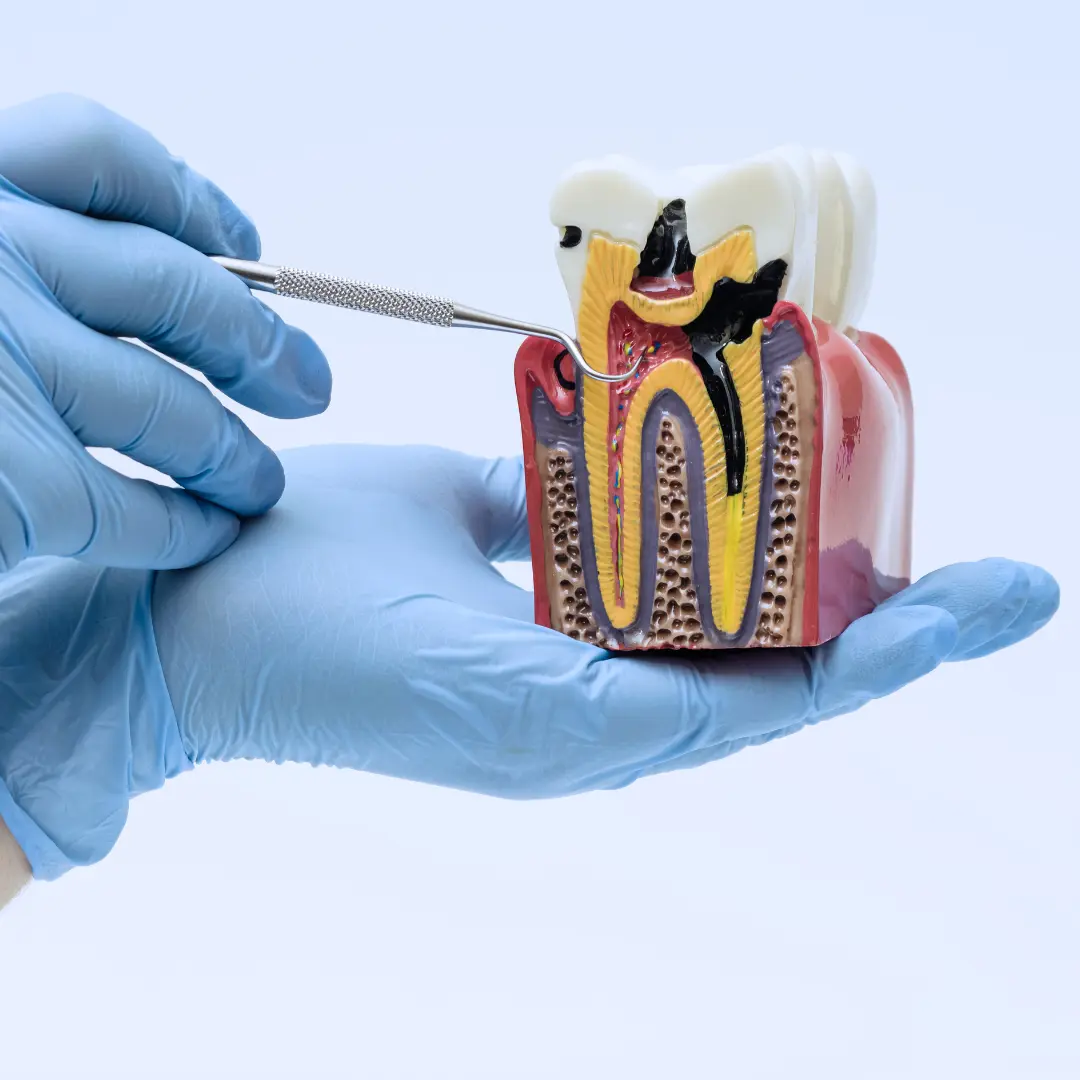 Endodontie