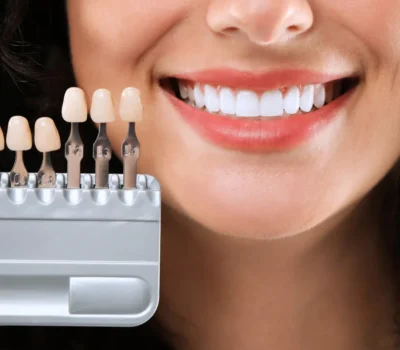 Estetica dentara