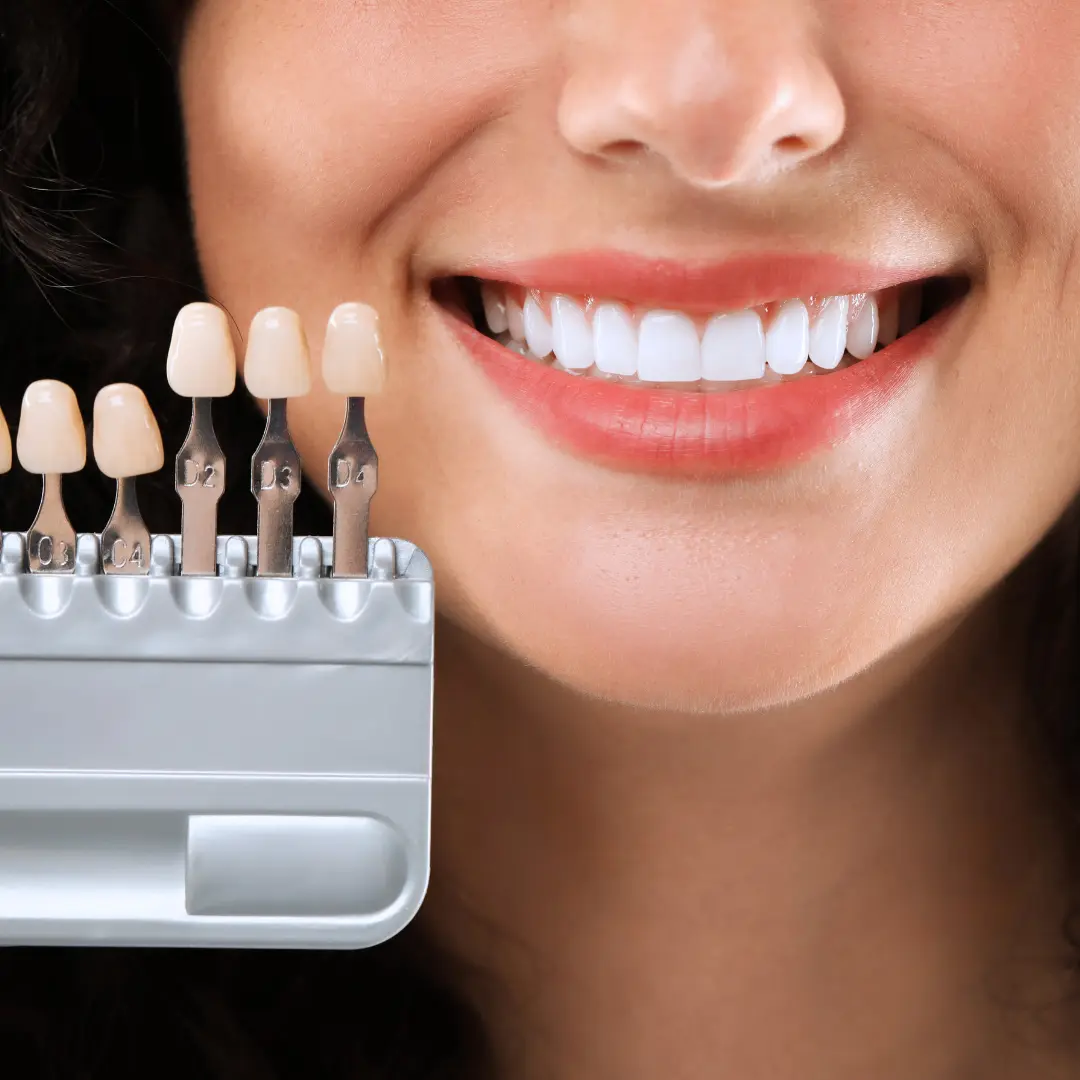 Estetica dentara