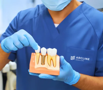 Implantologie dentara
